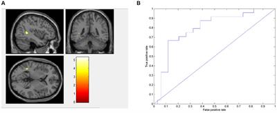 Machine learning research based on diffusion tensor images to distinguish between anorexia nervosa and bulimia nervosa